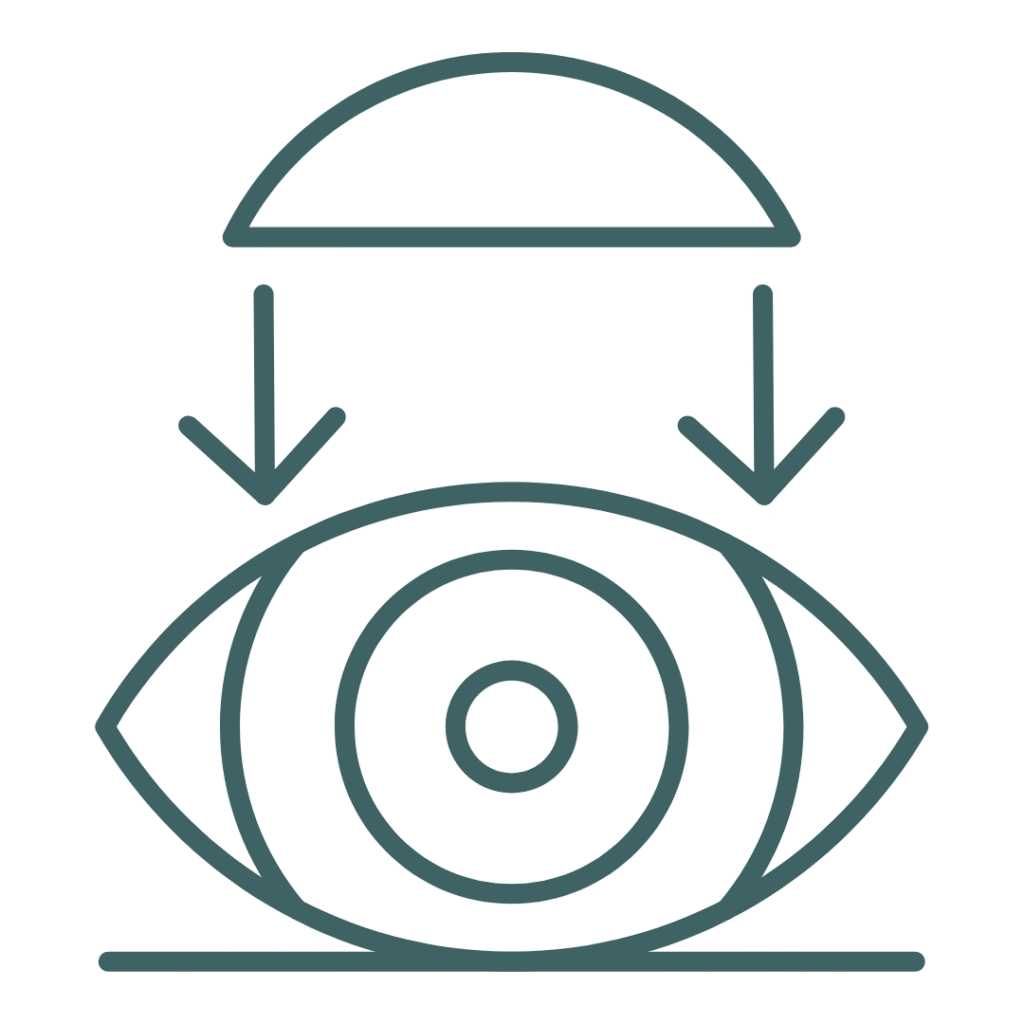 Gas Permeable (GP) Contact Lenses​