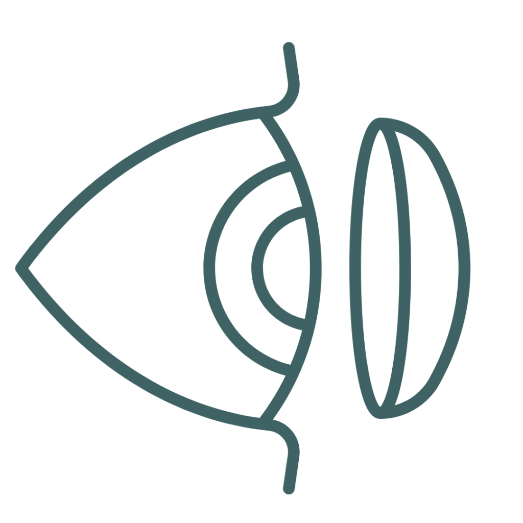 Toric Contact Lenses for Astigmatism​